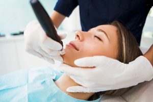 microneedling